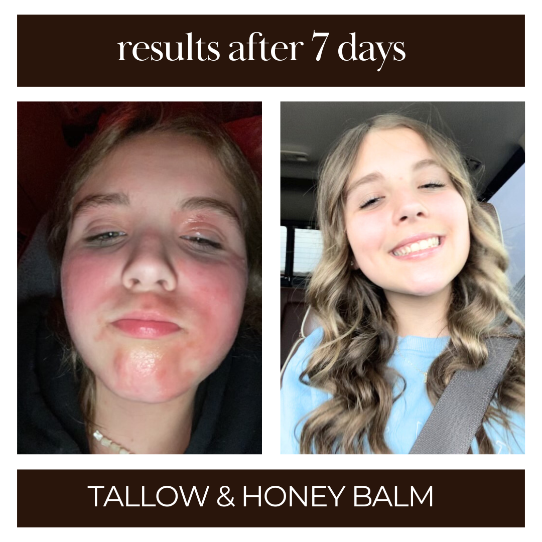 Tallow & Honey Balm