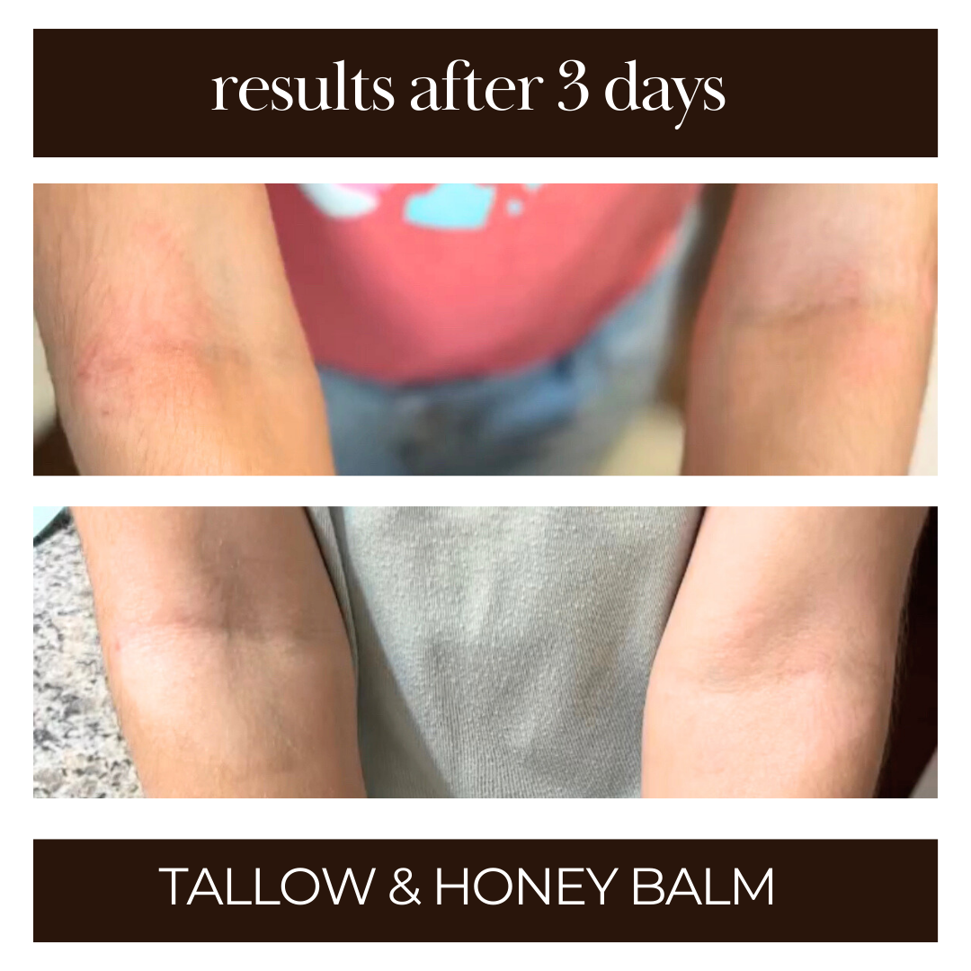 Tallow & Honey Balm